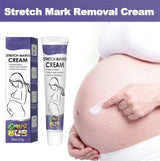 Stretch Mark Removal Cream Permanently Removes Stretch Marks Rejuvenates Skin Stretch Mark Removal Cream