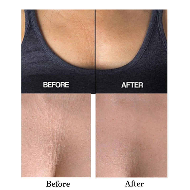 Anti-wrinkle Chest Pads Silicone Chest Patches Reusable Invisible Skin Lift Anti-Aging Wrinkle Pads Smoothing Wrinkle Patch