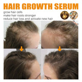 Biotin Hair Care Spray Nourish Scalp Hair Follicle Reduce Hair Loss Stabiliz Hair Root Refresh Oil Control Natural Plant Essence