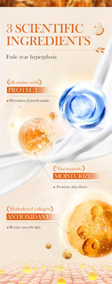 Stretch Marks Remover Essential Oil Pregnancy Maternity Body New Old Stretch Mark Removal Serum Increase Elasticity of Skin