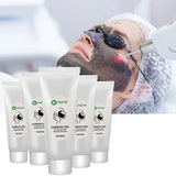 NEW Date Black Gel Mask For ND YAG Laser Skin Peeling Carbon Cream Whitening Peel Deep Cleaning Facial Rejuvenation Moisturizing