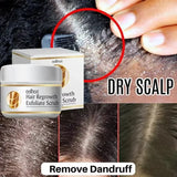 Fast Anti Exfoliating Scrub Remove Dandruff Anti Itching Treatment Seborrheic Scalp Oil Control Repair Scalp Beauty Health Care