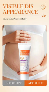 Stretch Marks Removal Cream Light Lines Postpartum Obesity Pregnancy Powerful Fast Absorption