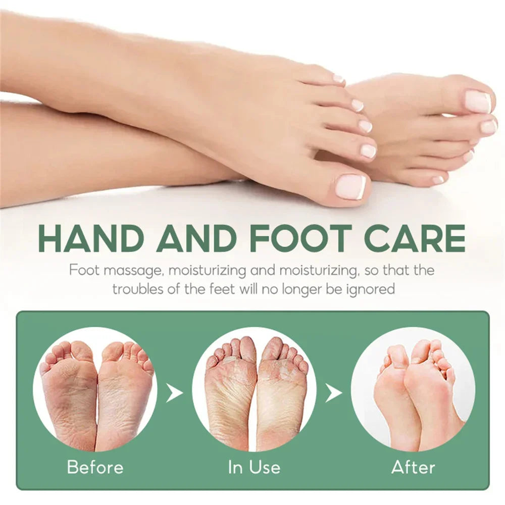 Herbal Anti Crack Foot Cream Spray Heel Cracking Repair Products Exfoliation Dead Skin Removal Softening Moisturize Smooth Care