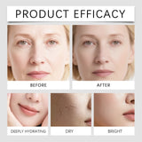Hexapeptide Collagen Microneedle Serum Set Hydrating Facial Roller Beauty Device Pro Home Beauty Care Kit Glowing Skincare