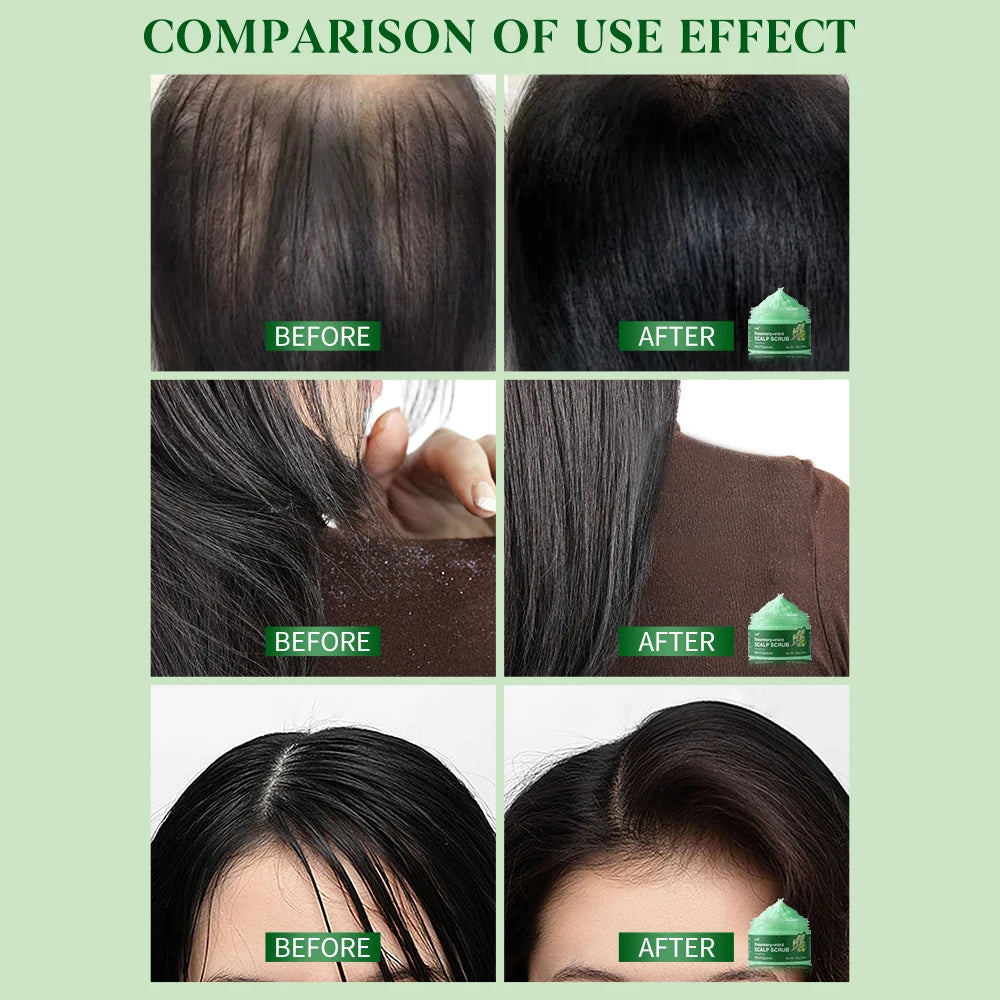 Hair Growth Spray,Scalp Scrub,Rosemary Scalp Exfoliator Scrub Shampoo,Hair Booster Serum,Strengthens Hair Roots,Helps Strengthen