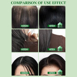 Hair Growth Spray,Scalp Scrub,Rosemary Scalp Exfoliator Scrub Shampoo,Hair Booster Serum,Strengthens Hair Roots,Helps Strengthen