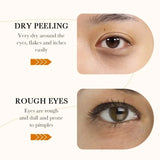 60 Pieces of Bioaqua Rice Eye Mask to Reduce Dark Circles, Remove Dark Spots, Tighten and Moisturize