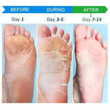 Herbal Anti Crack Foot Cream Spray Heel Cracking Repair Products Exfoliation Dead Skin Removal Softening Moisturize Smooth Care