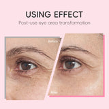 LAIKOU Sakura Roller Eye Serum 15ml Moisturizing Eye Care Reduce Dark Circles Puffiness Fine Lines Anti Aging Brightening Eye