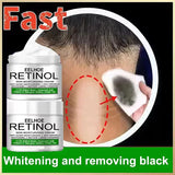 Body Whitening Cream Dark Skin Armpit Lightening Intimate Areas Underarm Bleaching Private Parts Whiten Cream Body Lotion Beauty