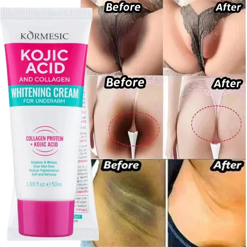 Whitening Cream Private Parts Underarm Bleaching Serum Whiten Butt Knee Brighten Inner Thigh Intimate Parts Dark Remove Melanin