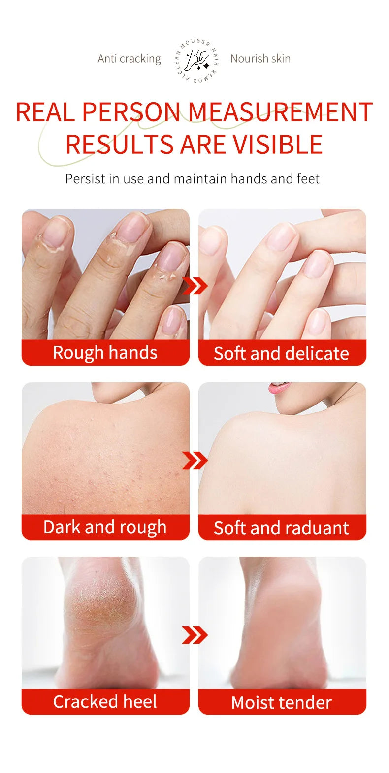 Herbal Anti Crack Foot Cream Heel Cracking Repair Products Exfoliation Dead Skin Removal Softening Moisturize Smooth Skin Care