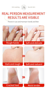 Herbal Anti Crack Foot Cream Heel Cracking Repair Products Exfoliation Dead Skin Removal Softening Moisturize Smooth Skin Care