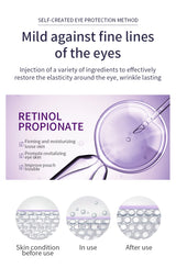 O'CHEAL Anti Wrinkle Anti Dark Circle Eye Cream Roller Massager Moisturizing Eye Bags Anti Aging Hyaluronic Acid Eye Skin Care
