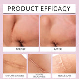 1 Roll Silicone Scar Sheets , 4cmX150cm Self-Adhesive Scar Cover Tape Reusable and Effective Skin Care Strips collagen scar tape