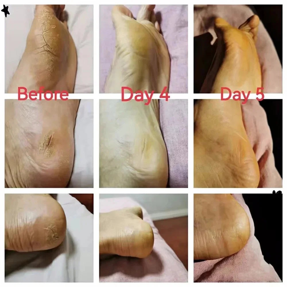 Herbal Anti Crack Foot Cream Heel Cracking Repair Products Exfoliation Dead Skin Removal Softening Moisturize Smooth Skin Care