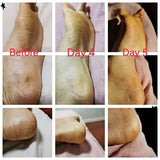 Herbal Anti Crack Foot Cream Heel Cracking Repair Products Exfoliation Dead Skin Removal Softening Moisturize Smooth Skin Care