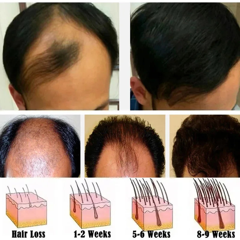 Hair Growth Serum 7 Days Fast Regrowth Essential Capsule Anti Hair Loss Baldness Repair Damaged Scalp Treatment For Women Men