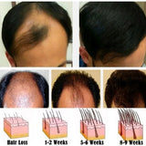 Hair Growth Serum 7 Days Fast Regrowth Essential Capsule Anti Hair Loss Baldness Repair Damaged Scalp Treatment For Women Men