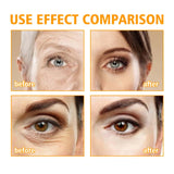 HOYGI 5D Peptide Eye Cream Relieve Puffiness Reduce Dark Circles Firming Fade Fine Lines Nourishing Smoothing Eyes Skin Care