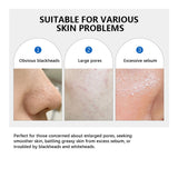Zero Pore Pad 2.0 Double Textured Facial Toner For Exfoliating And Smoothing Pores Korean Skin Care Pad For All Skin Types 70pcs
