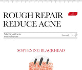 BIOAQUA Salicylic Acid Face Cream Acne Creams Mark Repair Firming Moisturizing Blackhead Remover skincare Facial Cream