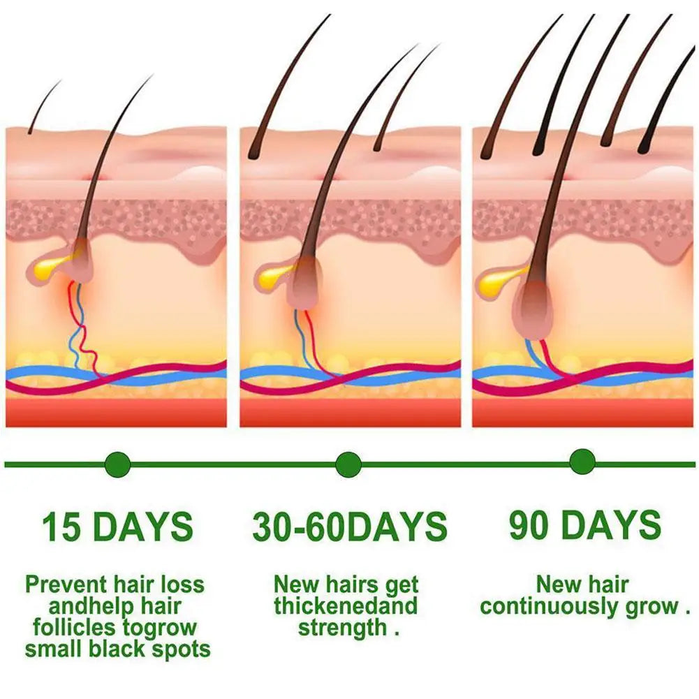 Anti-Hair Loss Serum Thinning Balding Treatment Oil Strengthen Hair Roots For Scalp Health Care Essence 20/30ml