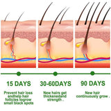 Anti-Hair Loss Serum Thinning Balding Treatment Oil Strengthen Hair Roots For Scalp Health Care Essence 20/30ml