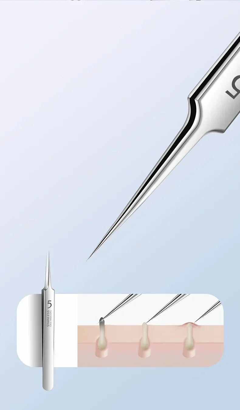 Optional 4Pcs 7Pcs 8Pcs Stainless Steel Skin Care Tool Set For Blackhead And Pimple Household Salon Grooming Accessory