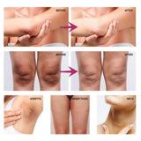 Whitening Cream For Dark Skin Underarm Armpit Thigh Inner Joint Lightening Sensitive Area Body Care Moisturizing Brighten Lotion