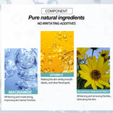 Freckle Whitening Cream Nicotinamide Fade Dark Spot Blemish Acne Mark Brightening Lightening Pigmentation Correction Cream