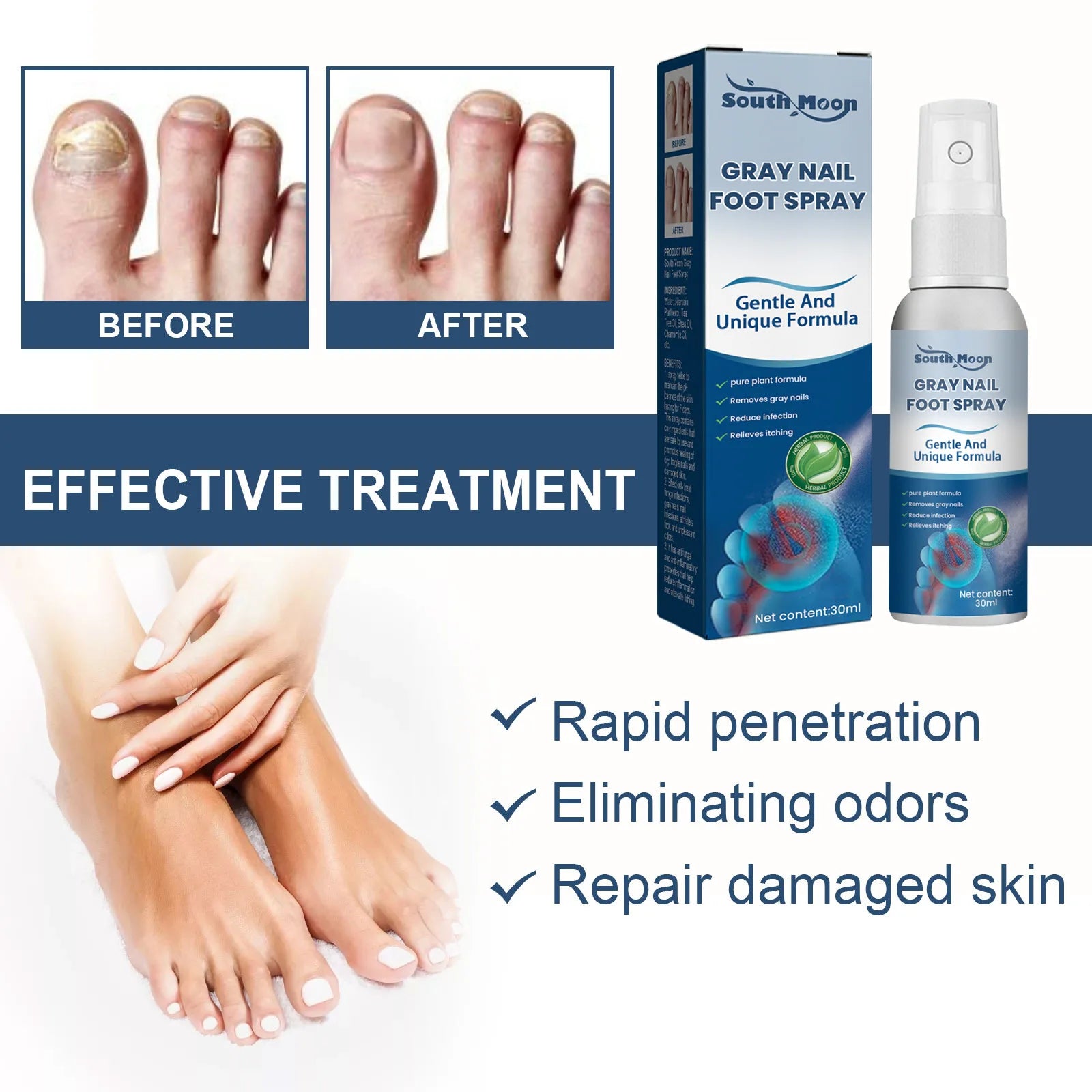 South Moon Foot Spray Anti Smell Remove Toenail Fungal Paronychia Onychomycosis Care Deodorant Antiperspirant Nail Repair Spray