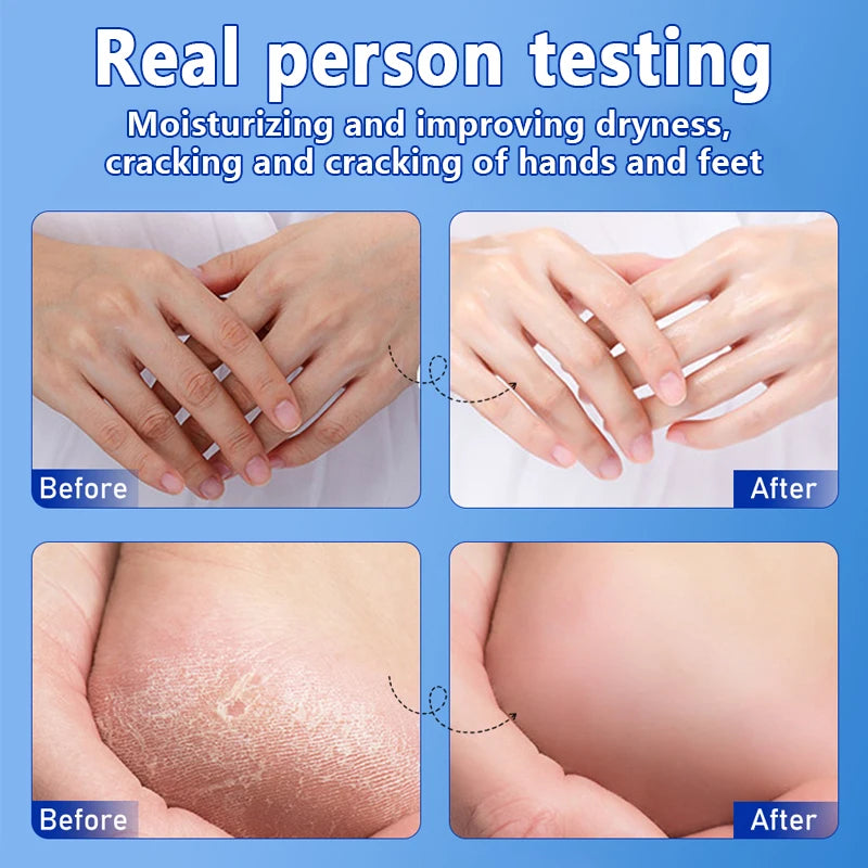 O’CHEAL 40g Foot Skin Care Cream Stick Nourishing Cream Hand Facial Cream Removal Dead Skin Moisturizing Hand Feet Gel Skin Care
