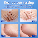 O’CHEAL 40g Foot Skin Care Cream Stick Nourishing Cream Hand Facial Cream Removal Dead Skin Moisturizing Hand Feet Gel Skin Care