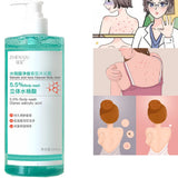16.9 oz Salicylic Acid Body Wash, Gentle & Smoothing  Mild Exfoliating Daily Acne Body Wash Deep Cleanses Back Acne and Sebum