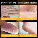 Intensive Cracked Skin Hydrating Balm – Ultra-Moisturizing Foot & Hand Cream for Dry, Rough Heels | Anti-Fissure & Nourishing