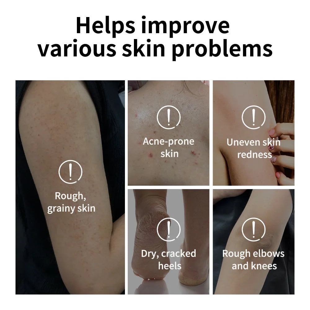 Lakerain Exfoliating Body Stick Multiple Glycolic Acid Cleaning Long-lasting Moisturizing Nourishing Smoothing Skin Care
