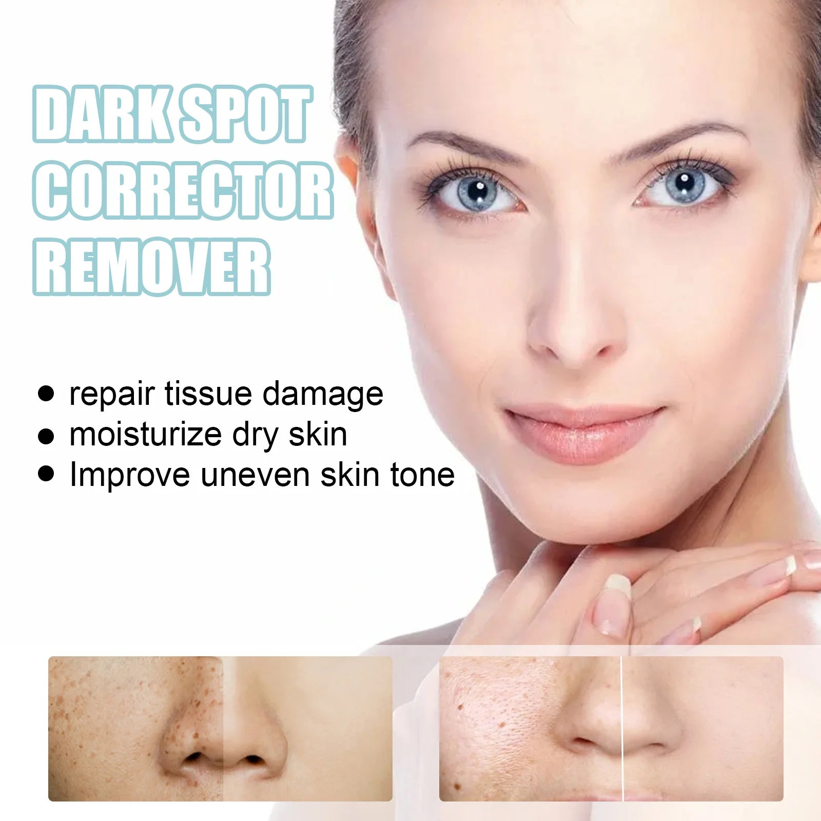 Freckle Whitening Cream Nicotinamide Fade Dark Spot Blemish Acne Mark Brightening Lightening Pigmentation Correction Cream