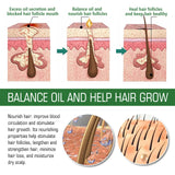 Rosemary Hair Growth Oil Anti-frizz Dandruff Treatment Scalp Damaged Nourishing Anti Hair Loss Serum Pure Rosemary Essential Oil