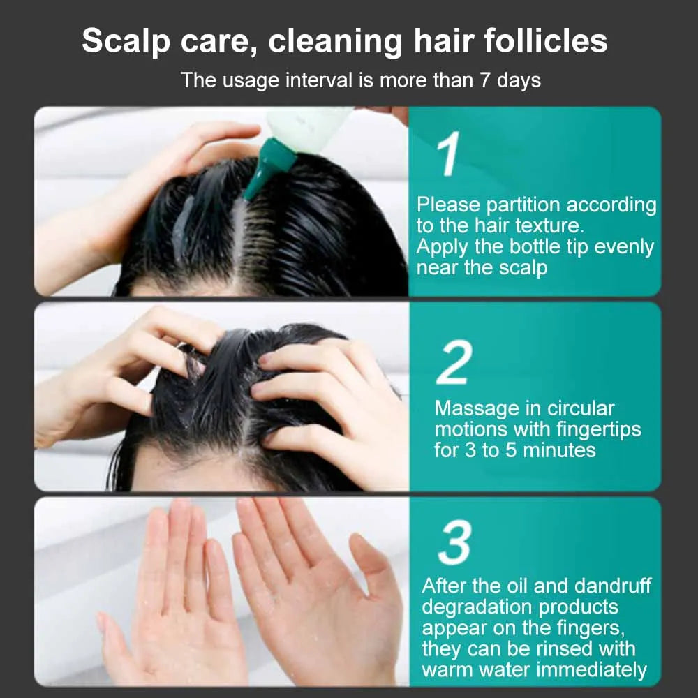 Zhangguang 101 Scalp Cleansing Gel Shampoo, Deep Hair Follicle Cleansing Liquid, Exfoliating, Oil Control, and Itching Relief Mi