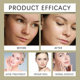 Glycolic Acid 7% Moisturizing Toner Remove Acne Improve Skin Condition Replenish Water Moisturize Skin Tender Skin&Toner Essence