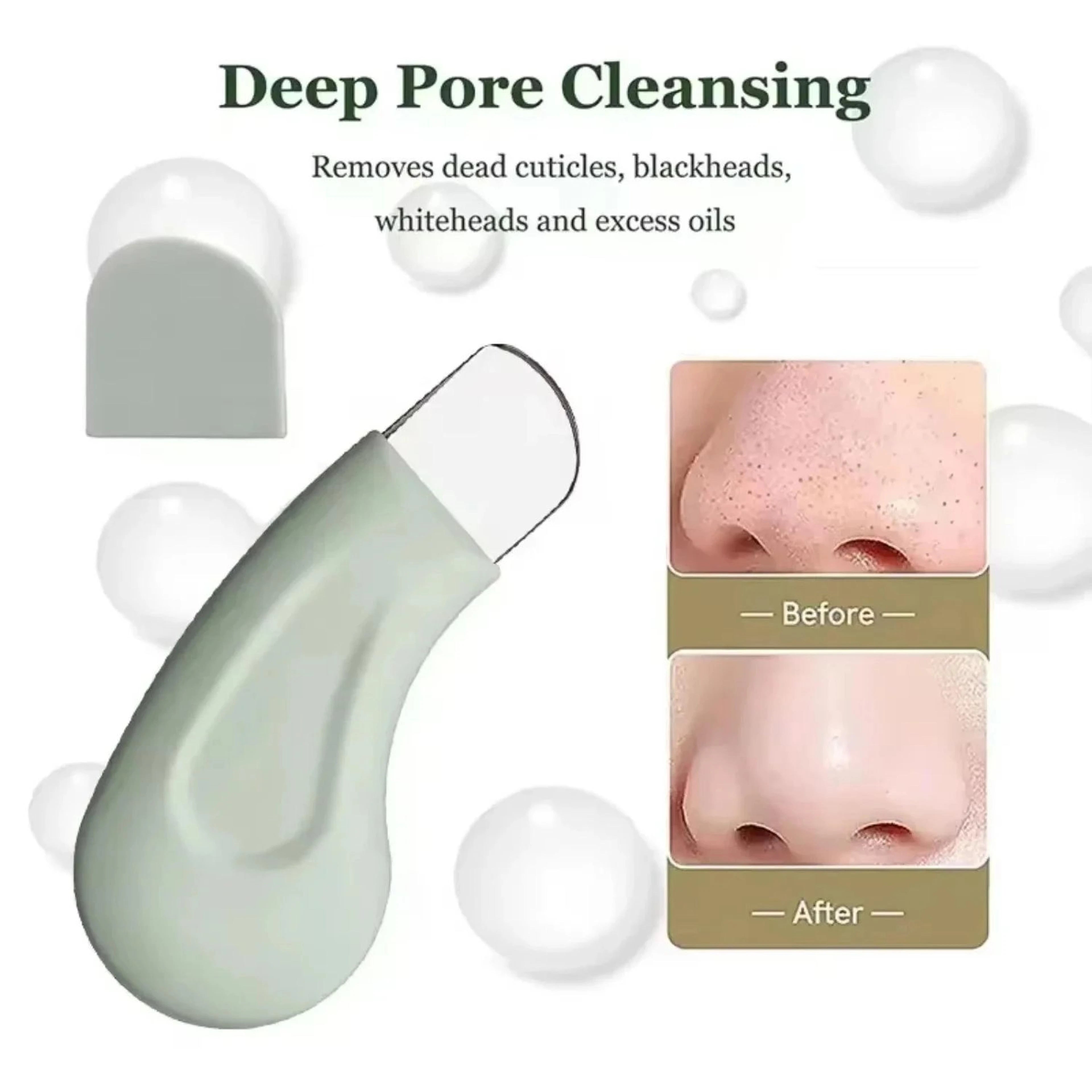 Facial Blackhead Removal Tool Nose Deep Cleansing Remove Whitehead Acne Handheld Beauty Care Tool
