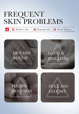 SADOER Kojic Acid Hand Cream Brightening Repair Dry Rough Skin Moisturizing Nourishing Smoothing Hydrating Daily Hand Care 30g