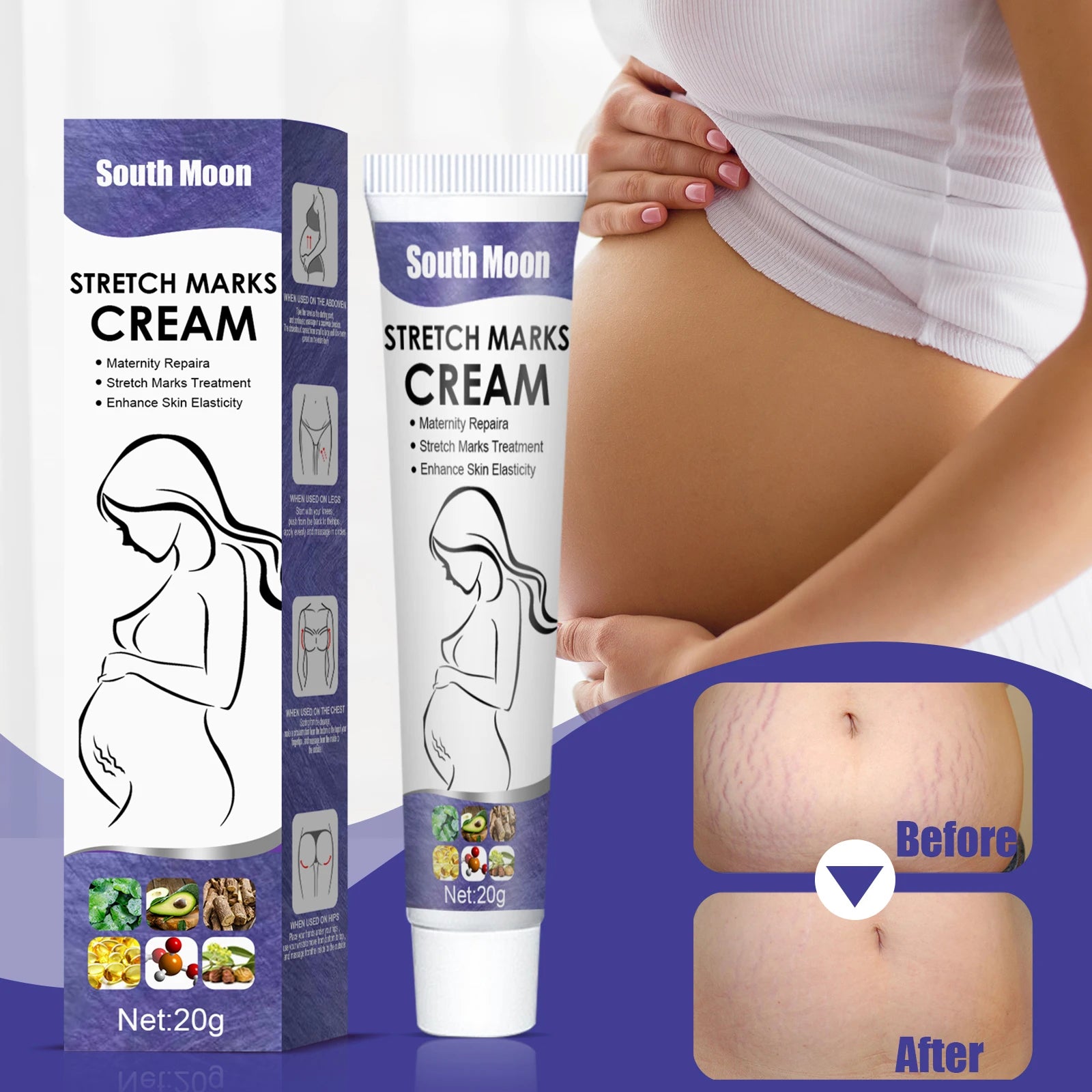 Stretch Marks Permanent Removal Cream Maternity Pregnant Women Pregnancy Anti-Winkle Smooth Repair Firming Skin Body Skin Care