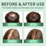 Hair Growth Spray,Scalp Scrub,Rosemary Scalp Exfoliator Scrub Shampoo,Hair Booster Serum,Strengthens Hair Roots,Helps Strengthen