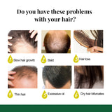 Ginger Oil Hair Booster Serum Spray Nourish Scalp Hair Follicles Refresh Control Oil Strengthen Hair Roots Nutrient Solution