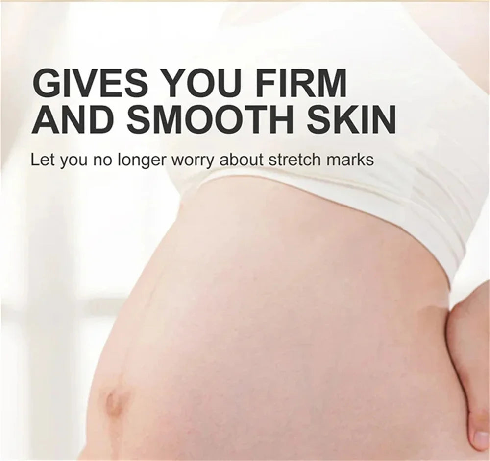 Stretch Marks Remover Essential Oil Pregnancy Maternity Body New Old Stretch Mark Removal Serum Increase Elasticity of Skin