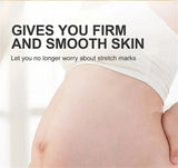 Stretch Marks Remover Essential Oil Pregnancy Maternity Body New Old Stretch Mark Removal Serum Increase Elasticity of Skin