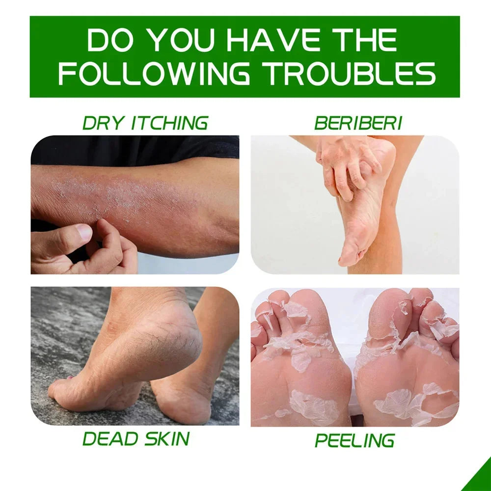 Herbal Anti Crack Foot Cream Heel Cracking Repair Products Exfoliation Dead Skin Removal Softening Moisturize Smooth Skin Care
